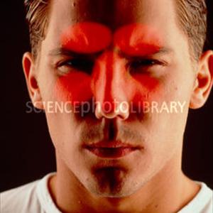 Sinusitis Infeccion - Sinus Headaches - Medication, Symptoms And Causes