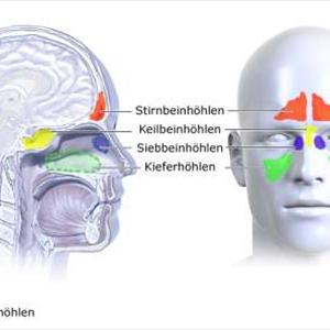 Of Sphenoid Sinus 