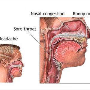 Sinusitis And Blurred Vision 