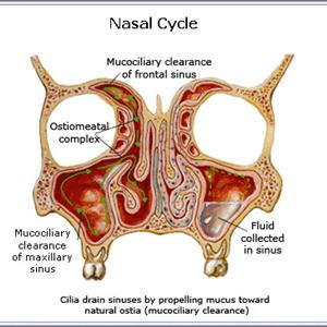 Sinusitis Halitosis - How To Get Rid Of A Sinus Infection?