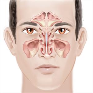 Immunity From Sinusitis